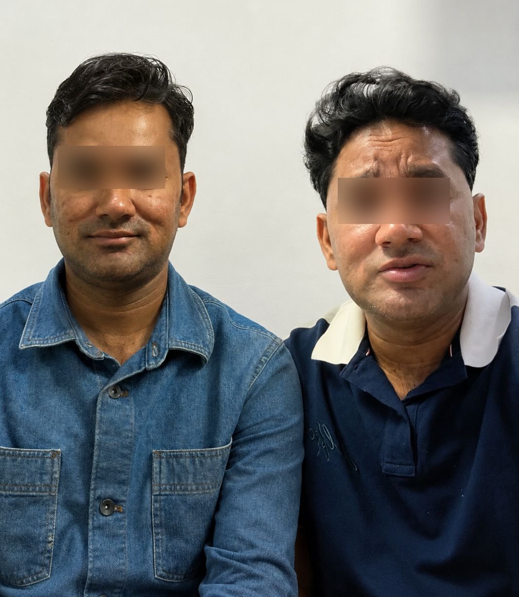 Microneedling
