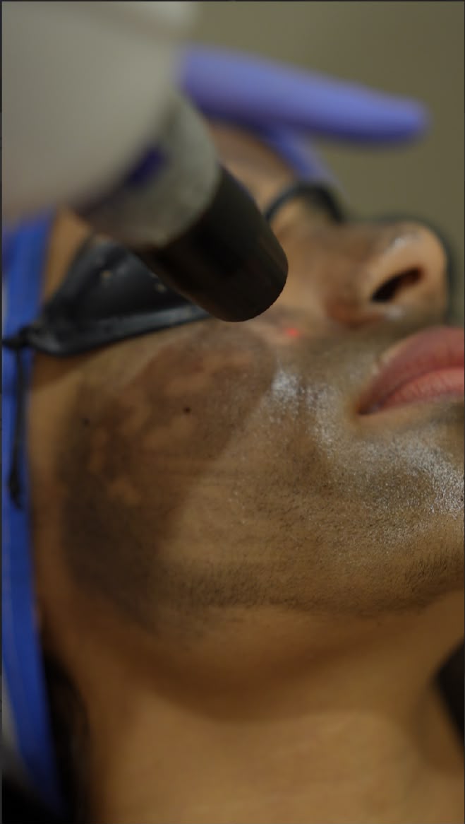 skin treatment